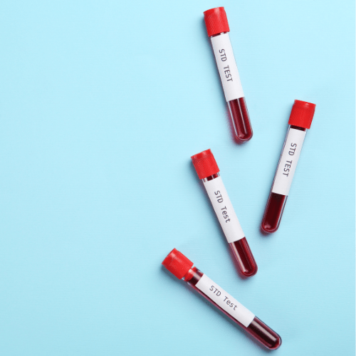 Why Getting an STI Test Before an Abortion Is Crucial